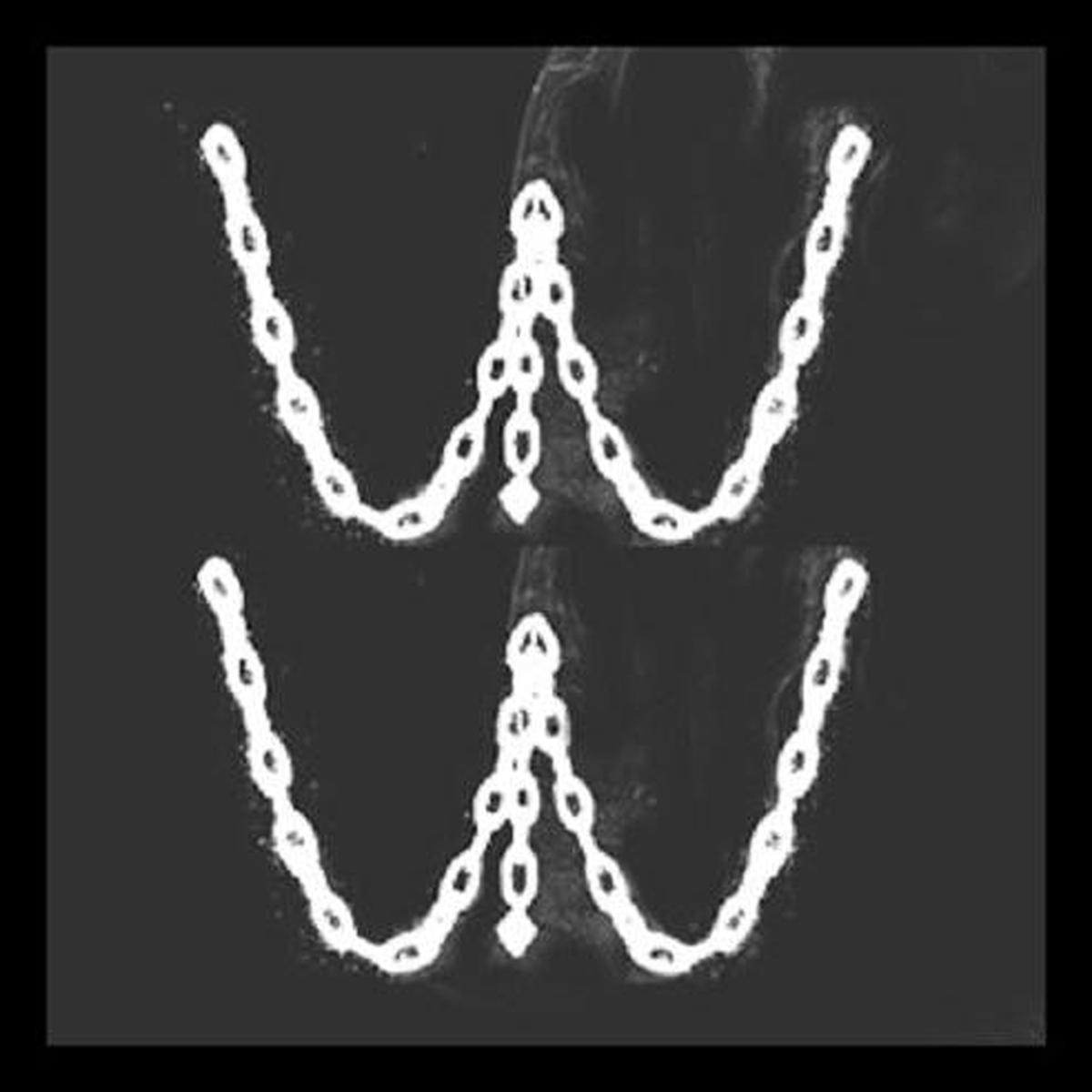 Women In The Woods - Stanza Nera (LP, Ltd) - USED